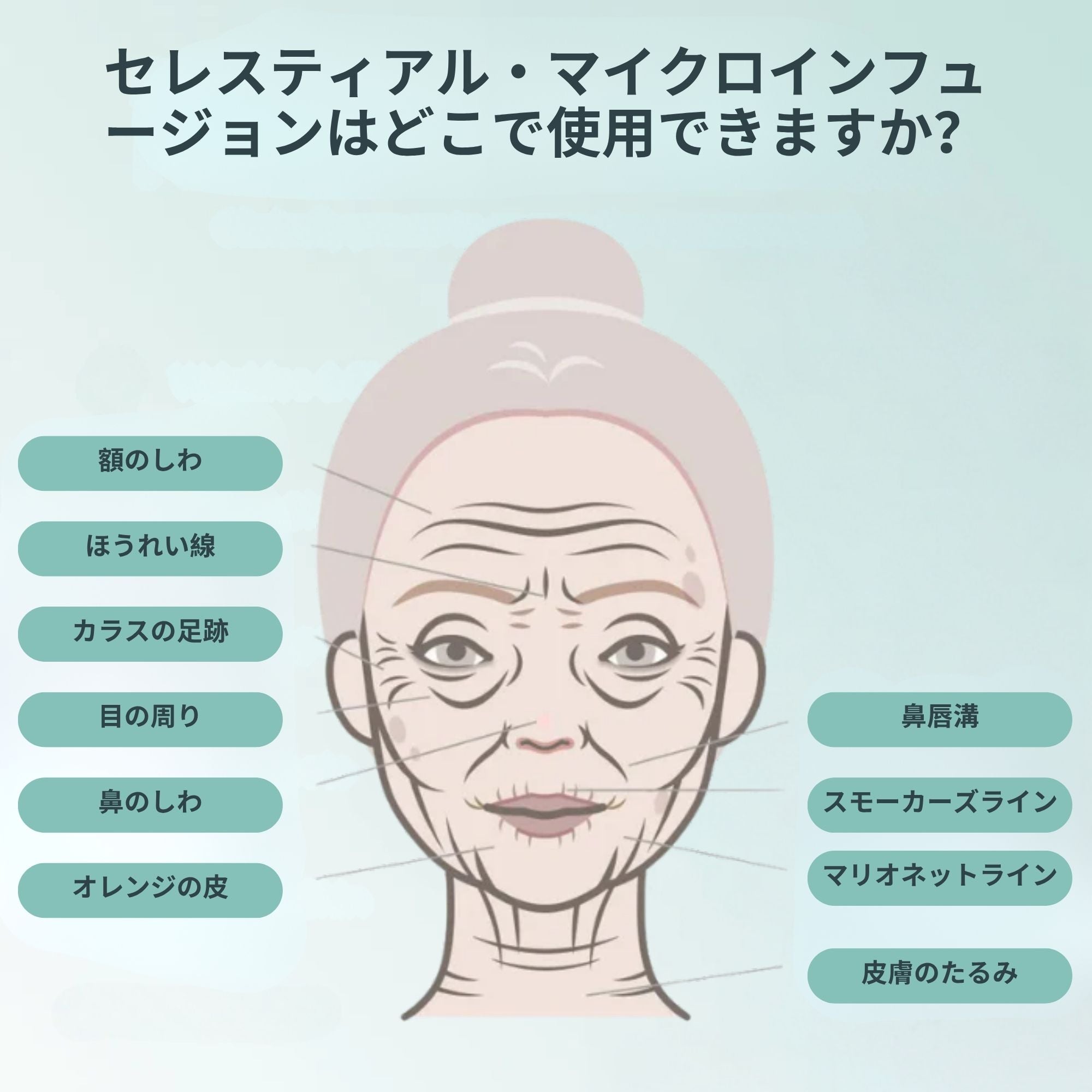 Celestia マイクロインフュージョン美容キット™